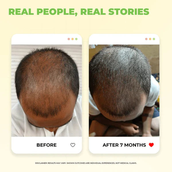 ELIVA Hair Oil – Reduce Hair Fall & Boost Healthy Hair Growth Naturally